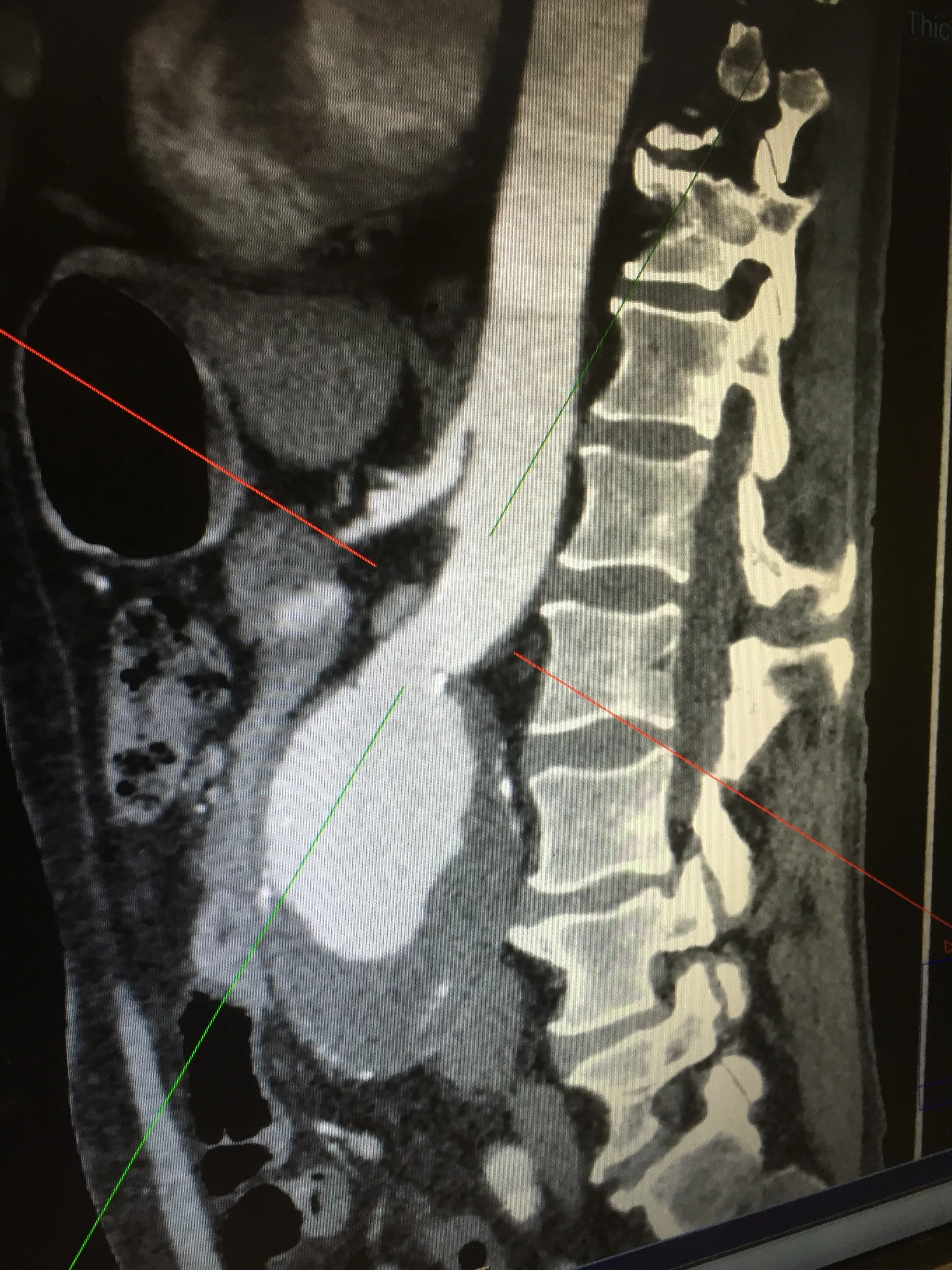 Image J